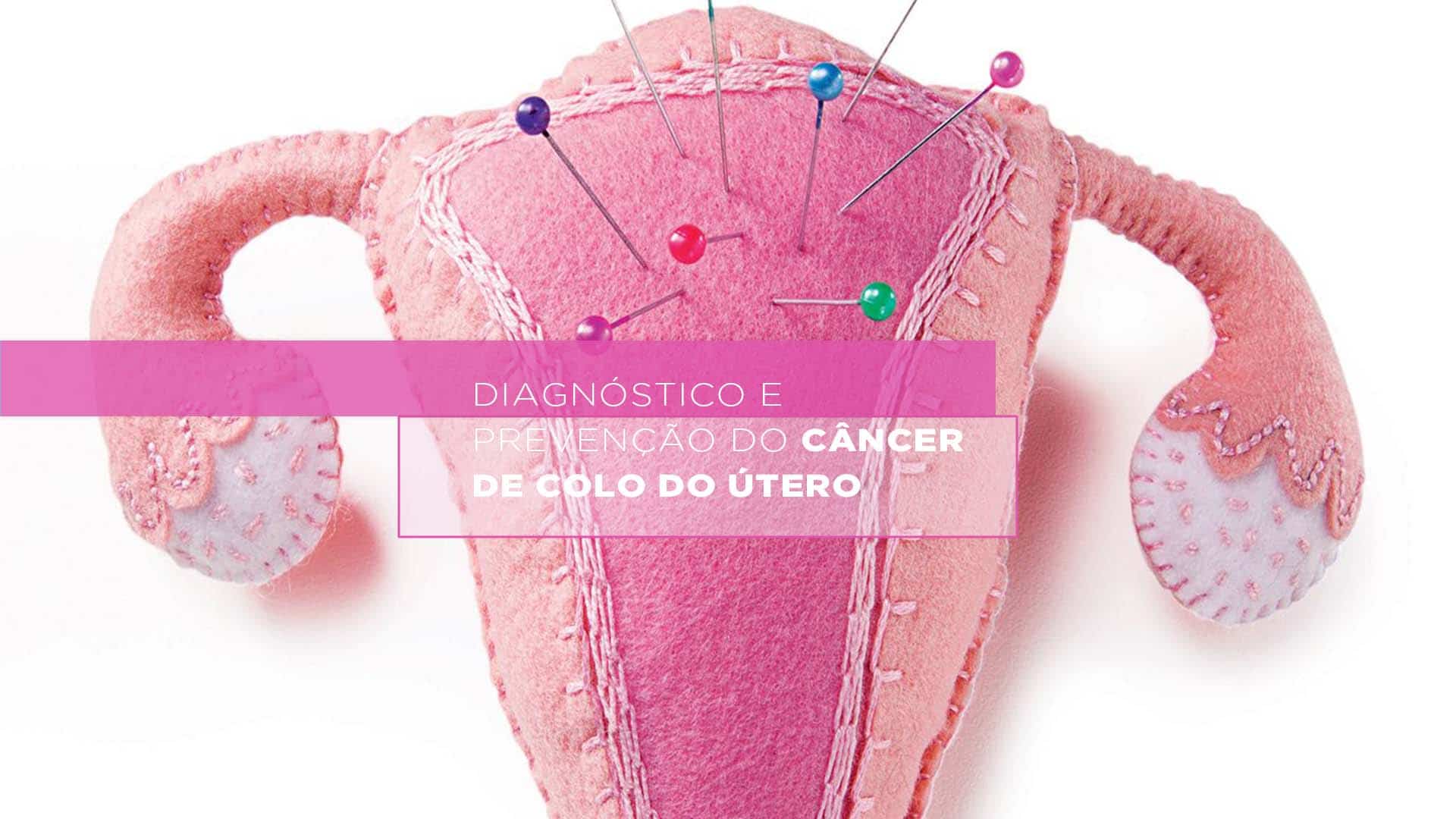 Outubro Rosa – Diagnóstico e Prevenção do Câncer de Colo do Útero
